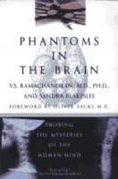 Phantoms in the brain